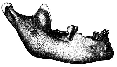 Human jaw bone